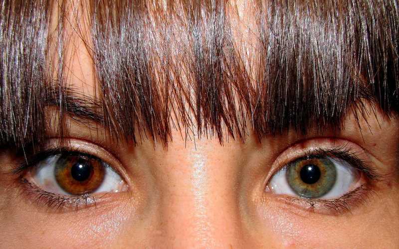 heterocromia: diferente cores entre os olhos de uma mesma pessoa